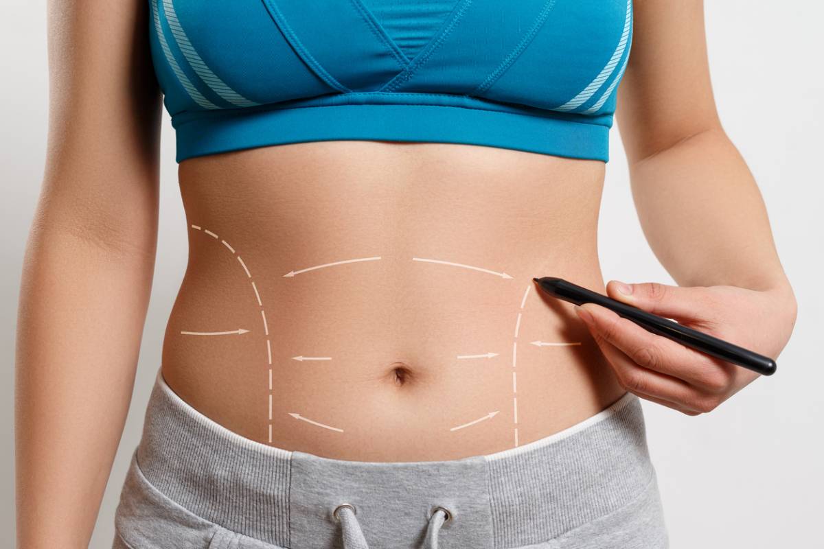 featured image for tummy tuck recovery guide