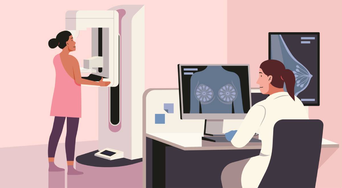 concept for what to know ahead of your screening mammogram