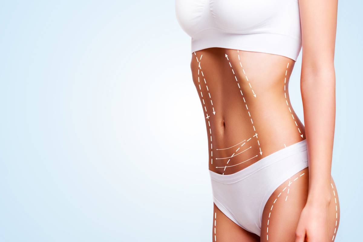 concept of woman after liposuction