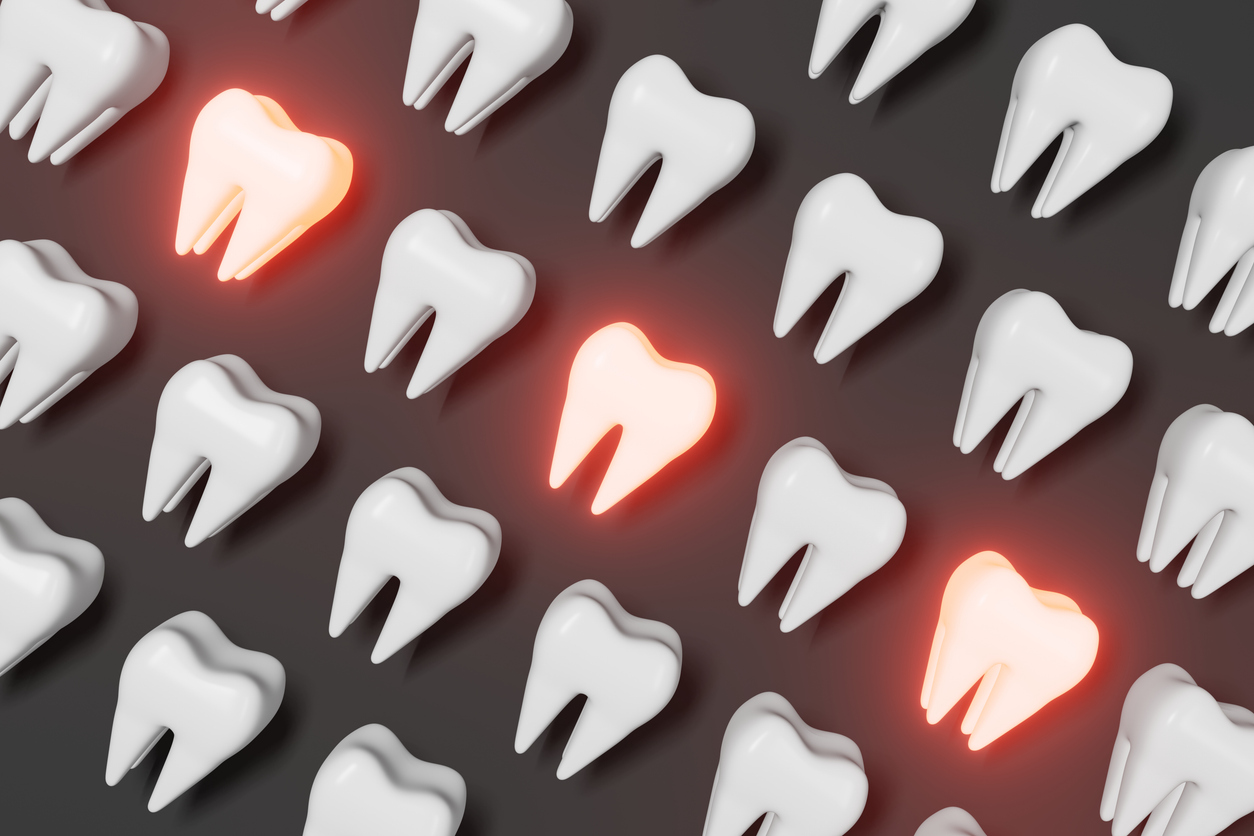 The image shows a 3d illustration of teeth in a pattern. Some of the teeth are red and shining to show injury and introduce the signs you need a root canal.