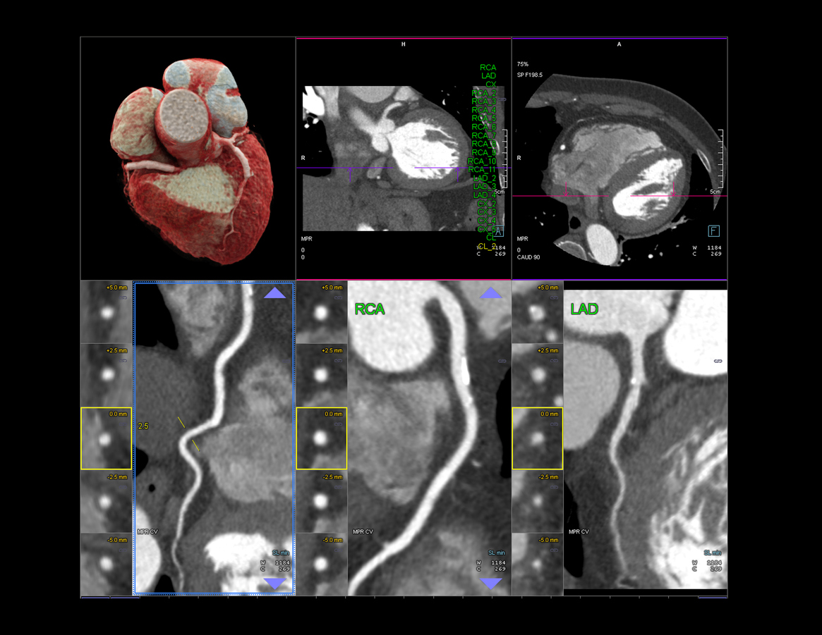 Featured image for When Should You Go For Cardiac CT Imaging