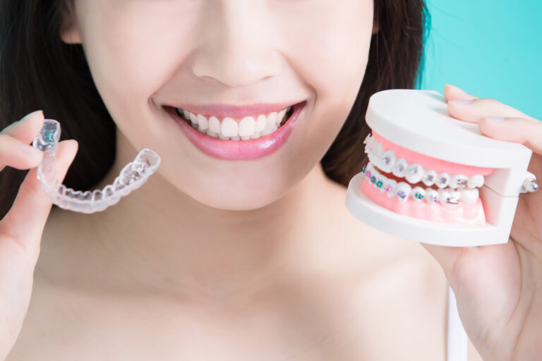 Featured image for What Are the Different Types of Orthodontic Treatments