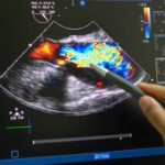 concept for which type of echocardiogram is best for you