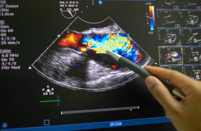 concept for which type of echocardiogram is best for you