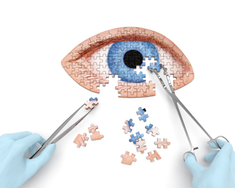 Featured image for Lifestyle Changes To Reduce Dark Circles