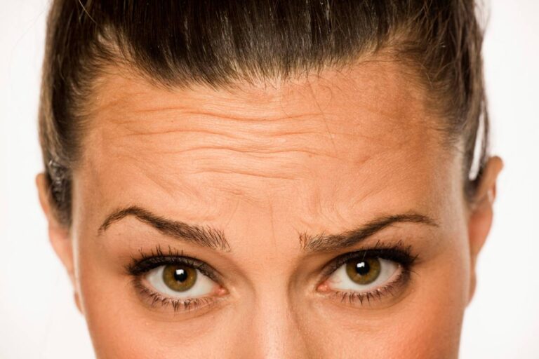 Featured image for At What Age Do You Develop Wrinkles?