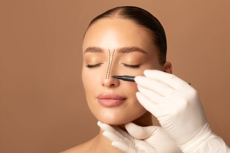 Featured image for How to Prepare for Rhinoplasty