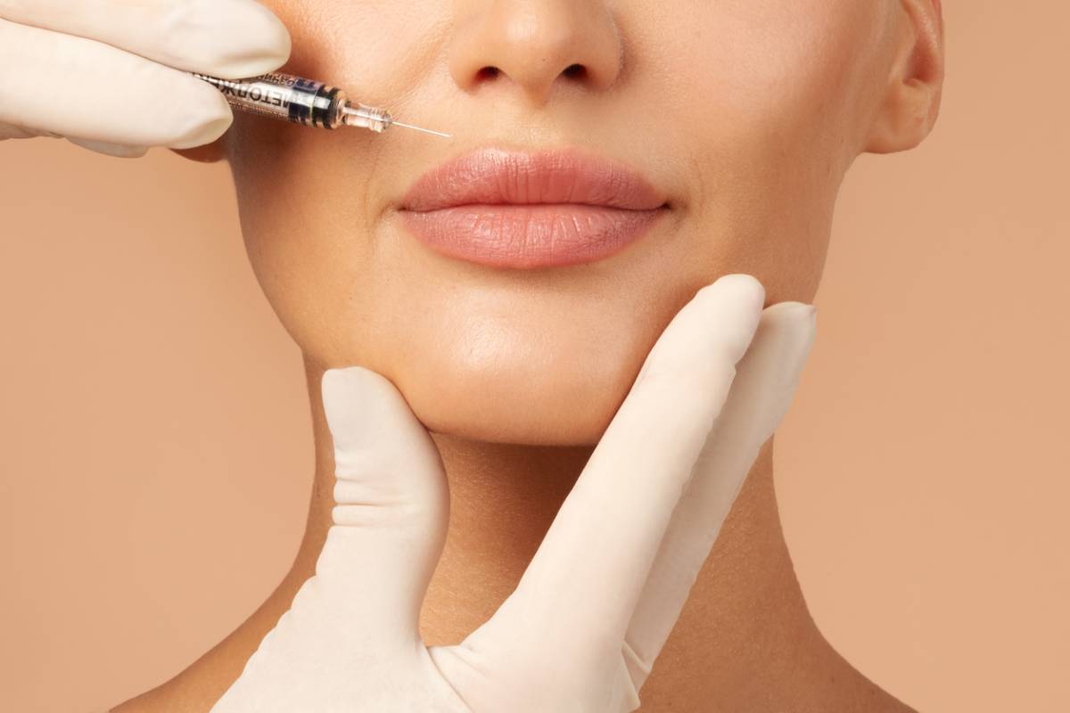 featured image for what is the difference between lip filler and lip augmentation